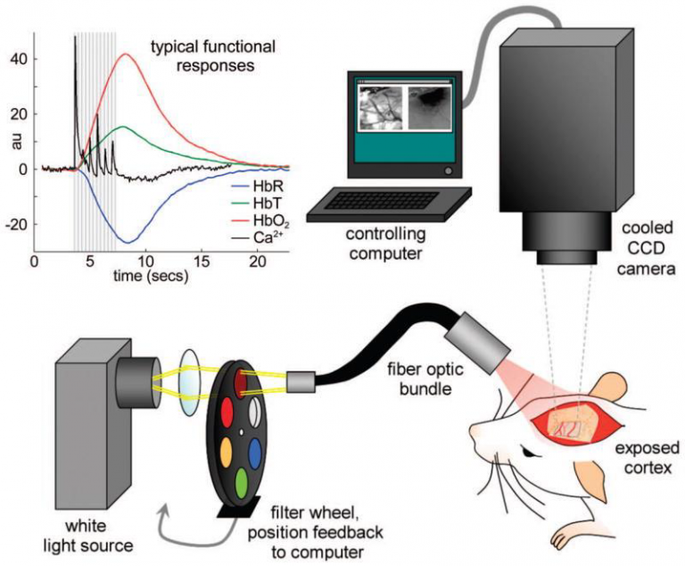 Intrinsic Signal Optical Imaging