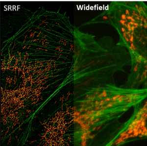 Super Resolution Imaging Learn Teledyne Photometrics