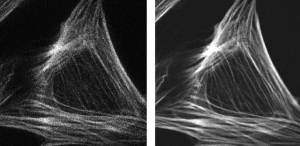 spinning disk confocal psf