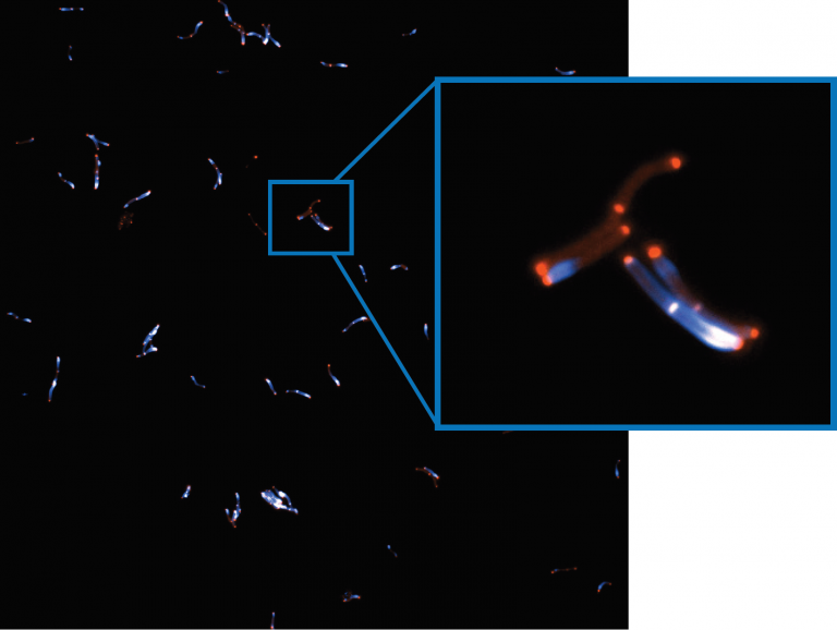 Customer Story - Prof. Suliana Manley - Super Resolution